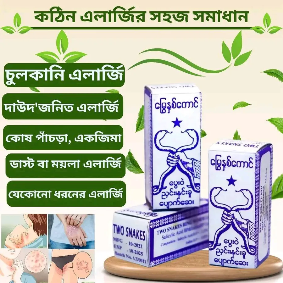 কঠিন এলার্জির সহজ সমাধান - Two Snakes Ring Warm Lotion